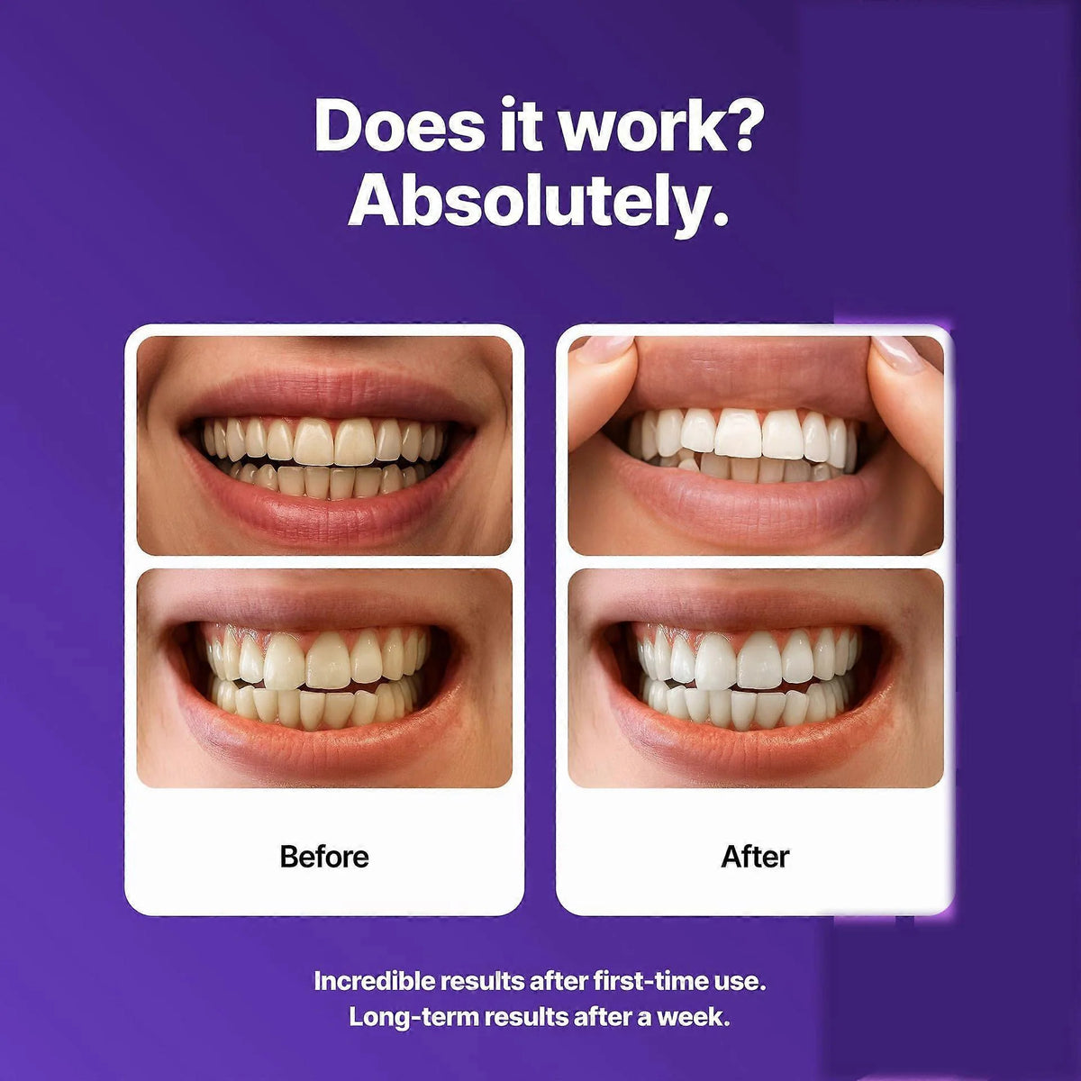 PURPLE WHITENING STRIPS DR WHITE